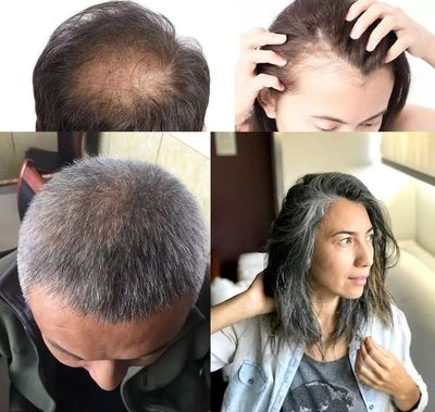 洗頭水中撒一把，頭發長得又快又茂密，白發都沒了！